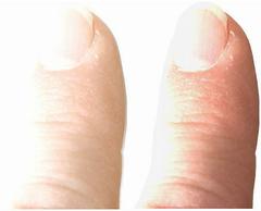 THE K. W. GÜSTROW COLLECTION -A SURVEY OF DARK AGE AND EARLY MEDIEVAL COINAGES THE OSTROGOTHS IN ITALY THEODAHAD, 534-536 No.: 420 Estimate: $ 50 d=39 mm Nummus, bronze, in the name of Justinian I, Ro