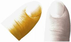 THE K. W. GÜSTROW COLLECTION -A SURVEY OF DARK AGE AND EARLY MEDIEVAL COINAGES THE OSTROGOTHS IN ITALY BADUILA, 542-552 No.: 423 Estimate: $ 80 d=33 mm Lot . Nummus, Ticinum (Pavia), 0.70 g.; MIB I, 8